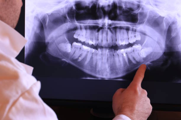 Best Dental Abscess Treatment in Willard, MO